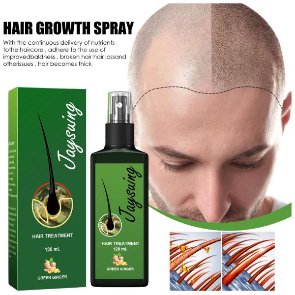 2024 Hot Selling hair Dense Spray, Strong And Nourishing hair Root, Scalp Massage Nutrient Liquid